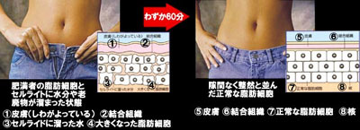 �C�����F���EBefore��After