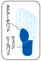 ソルボアーチウェッジヒールサポーター