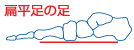 ソルボアーチウェッジヒールサポーター